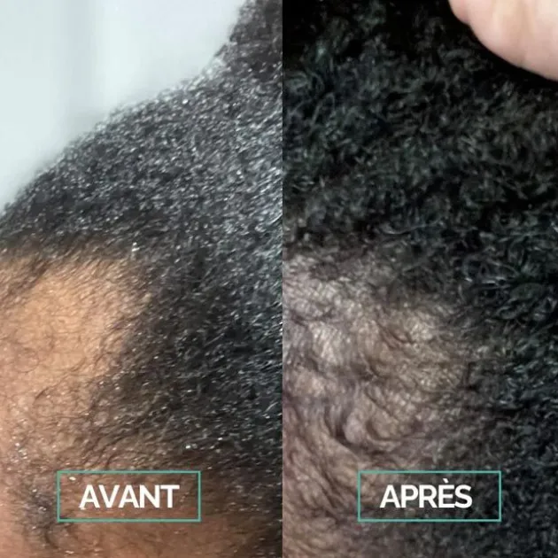 In Haircare Sérum cheveux croissance Boost & Scalp - 50 ml