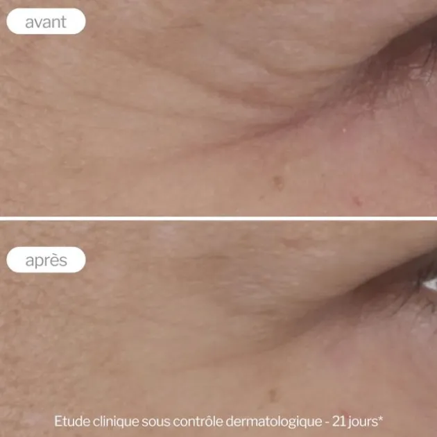 Novexpert Contour des yeux anti-âge Expert - 15 ml