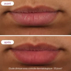 Novexpert Soin volumateur de lèvres Lip'Up - 8 ml