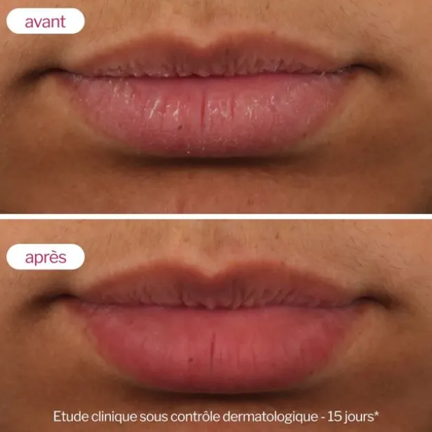 Novexpert Soin volumateur de lèvres Lip'Up - 8 ml