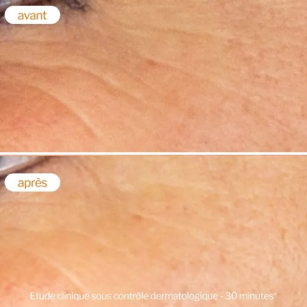 Novexpert Sérum booster à la Vitamine C - 30 ml