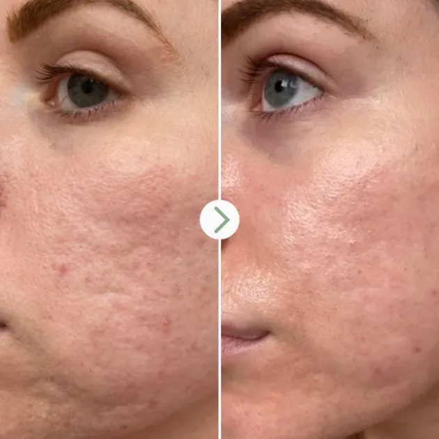 Pai Skincare Booster Hydratant Acide Hyaluronique - 10 ml