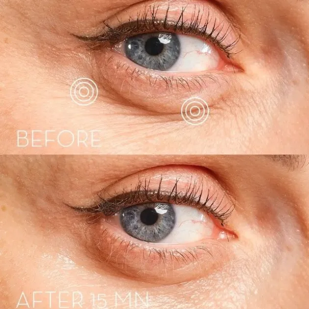 Skin Office Paris Patchs contour des yeux Eye Precision